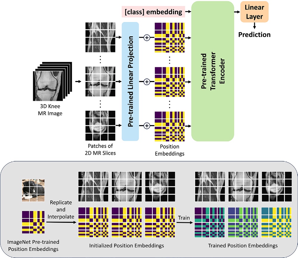 MR-Transformer architecture for knee MRI-based total knee replacement prediction
