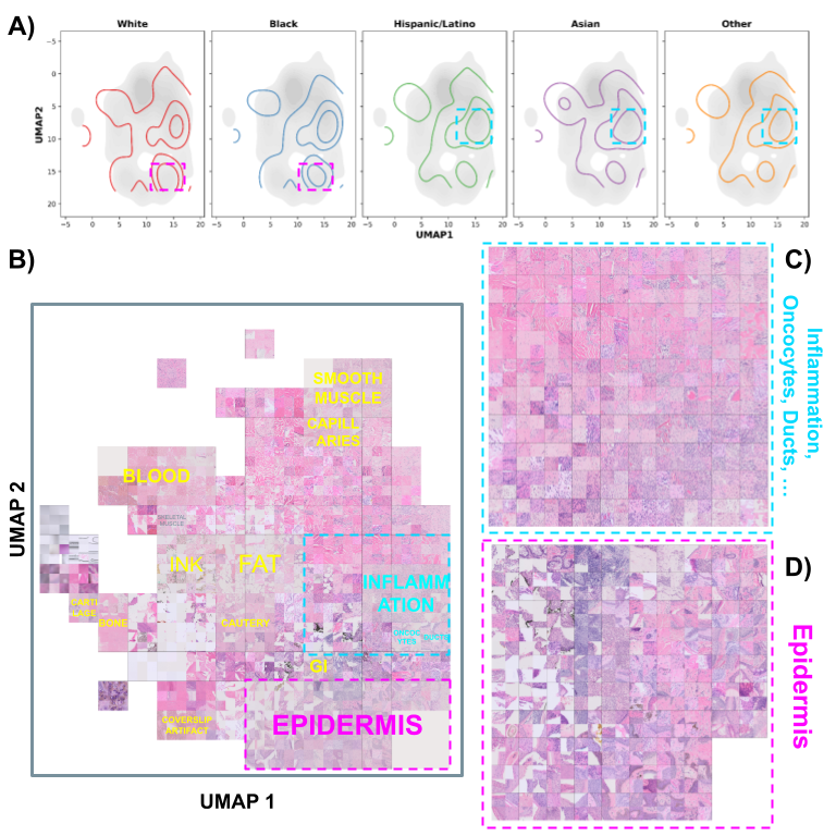 Histology-tile UMAP highlighting inflammation-related and epidermal regions